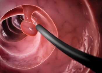 The Value of a Colonoscopy