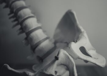 A conversation with Brandon Pollard, chronic pain patient