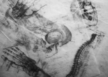 A conversation with Kellie Gasser, chronic pain patient and advocate