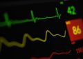Learn the New Atrial Fibrillation Guidelines
