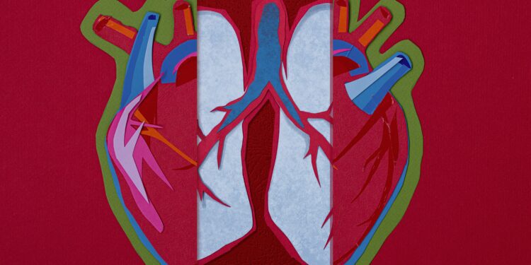 Stress Cardiomyopathy Mortality From Opioid Cessation