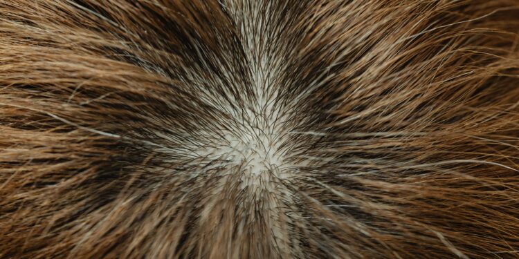 Understanding the Hair Growth Cycle