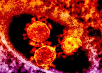 Understanding the Hidden Risks: Why Some Children Experience Severe Illness from RSV