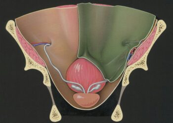 More Than a Pop Star Problem: Miley Cyrus, Ovarian Cysts, and the Silence Around Gynecological Pain