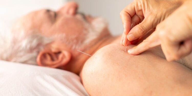 A senior man lays down without a top on as a care provider places acupuncture needles into his shoulder.