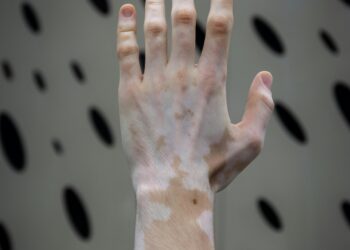 Upstream Hormones: The Quiet Return of DHEA and Pregnenolone in Complex Chronic Care